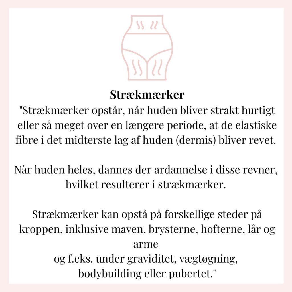 hvad er strækmærker og hvad kommer strækmærker af på mave og ryg